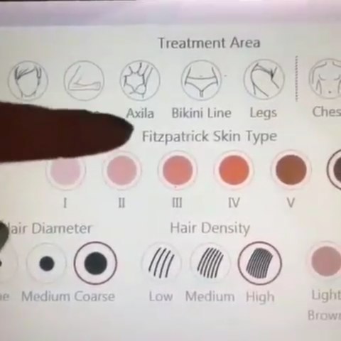 Pantalla del equipo de depilación láser: zona de tratamiento, fototipo de piel, diámetro y densidad del pelo
